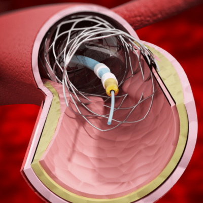 untitled (600 x 600 px) (634 x 600 px) (371 x 361 px) (400 x 400 px) (5)